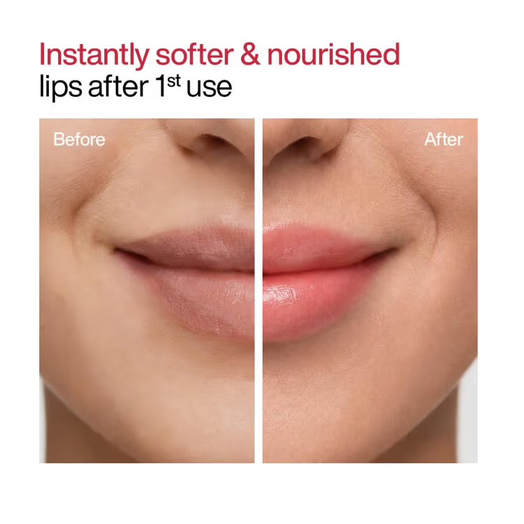 WishCare Ceramide Lip Balm